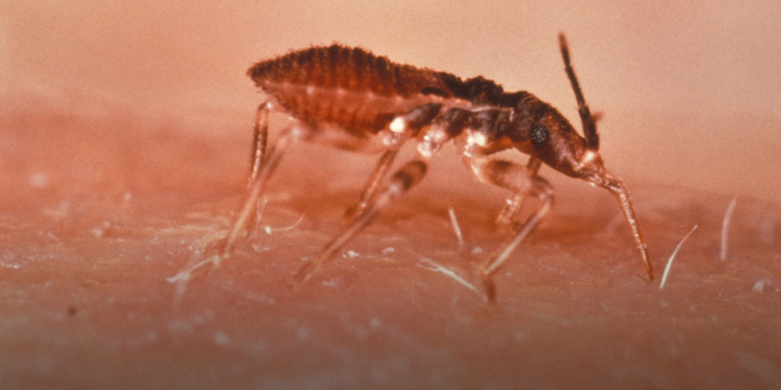 Chile notificó 1.915 casos de enfermedad de Chagas en 2025